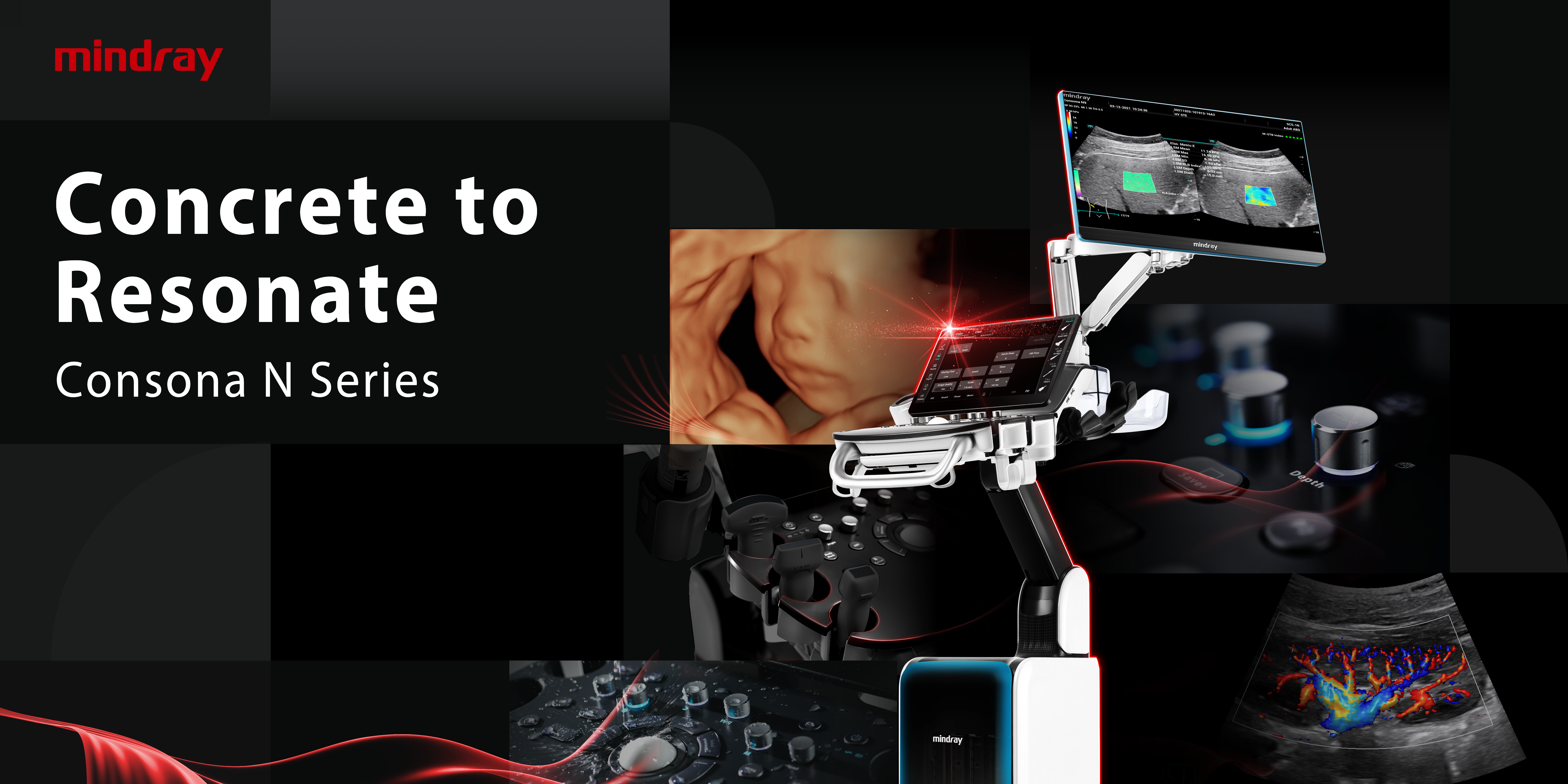 Transforming Cardiovascular Diagnoses: Unveiling Mindray's Consona Series Transforming Cardiovascular Diagnoses: Unveiling Mindray's Consona Series